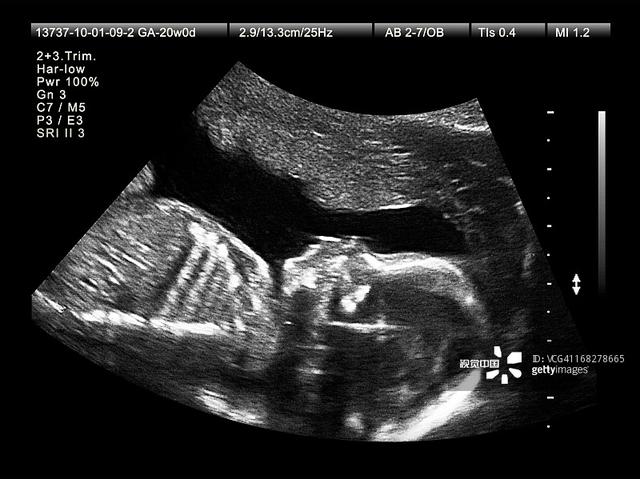 孕期6次超声检查准确时间表！建议宝妈收藏！