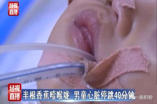 男童吃香蕉心脏停止半小时，你的无知，极有可能害死你的孩子