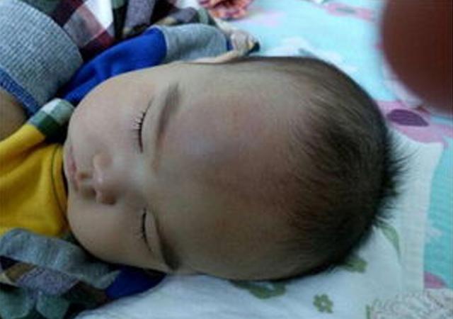 孩子磕到头，宝妈的做法，连医生都为她点赞