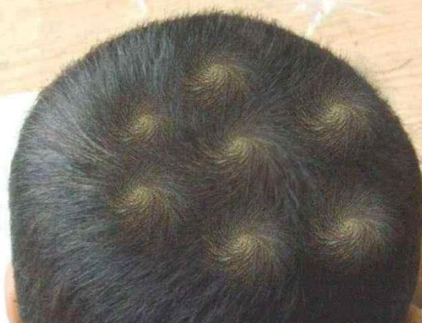 孩子头上“旋”越多越难管教？“旋”的个数与孩子性格有何联系