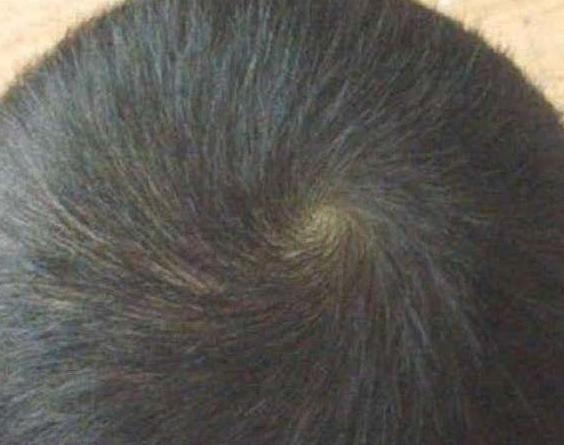 孩子头旋个数代表什么？越多越聪明吗？宝妈们别再迷信了！
