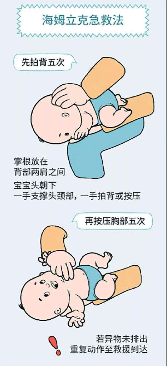 教你一分钟学会小儿哈姆立克法，最实用的儿童急救方法！