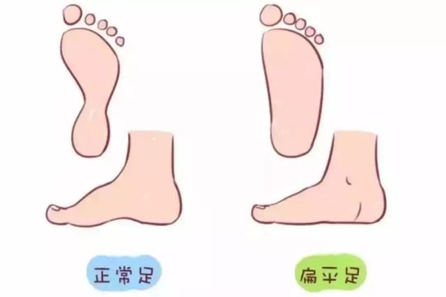 这样给宝宝选鞋最毁脚，某宝的销量千万别当真！