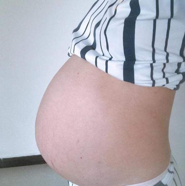 妊娠纹很挑人，这四种孕妈几乎避无可避，只有一种能够自己控制