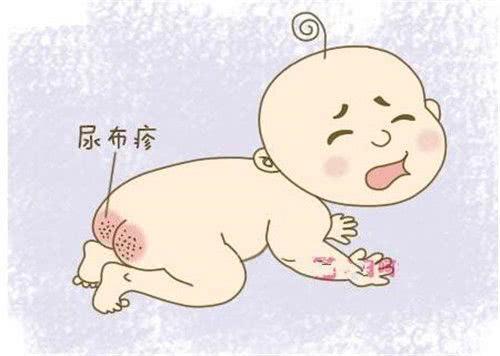 尿布疹正确护理方法，想要宝宝远离红屁股，护理做好这3点是关键