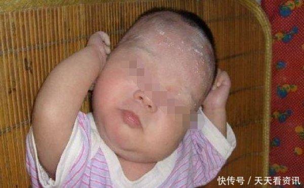 刚满月的孩子老是摇头, 奶奶夸孩子聪明, 医生检查后全家绝望