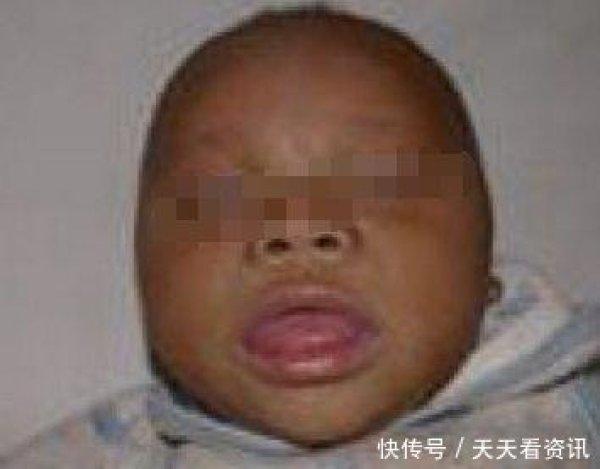 刚满月的孩子老是摇头, 奶奶夸孩子聪明, 医生检查后全家绝望