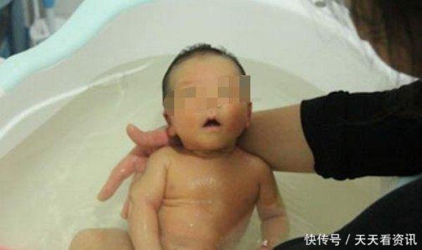 刚满月的孩子老是摇头, 奶奶夸孩子聪明, 医生检查后全家绝望
