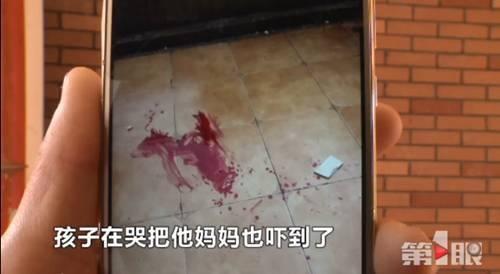 3 岁女孩脸部粉碎性骨折：真凶遍布每个小区