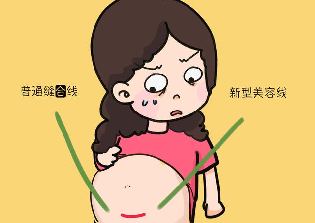 为啥剖腹产都不会留“蜈蚣疤”了？和这根线有关，好处挺多的！