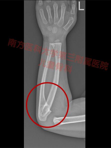 你知道吗，现实生活中真的有种疾病叫“一碗水端不平”