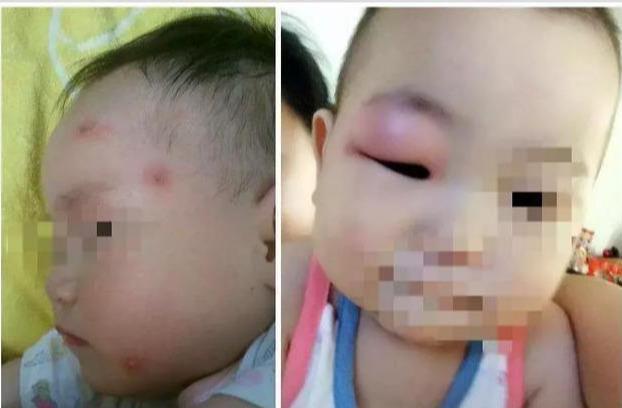 还在傻乎乎买蚊香？只要一食材，不花钱就让整个夏天蚊子死光光！