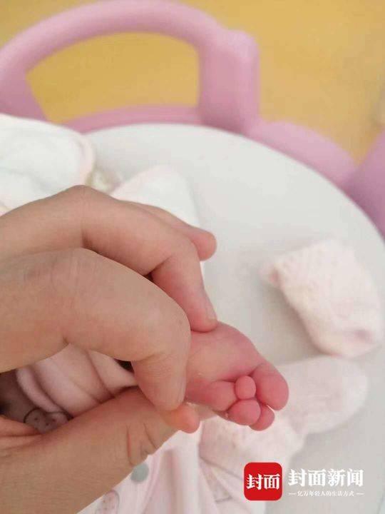 四维彩超显示有“双手” 婴儿出生无右臂 院方：确实漏诊了，愿承担相应责任