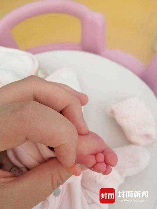 四维彩超显示正常 婴儿出生发现无右臂 院方：属于漏诊