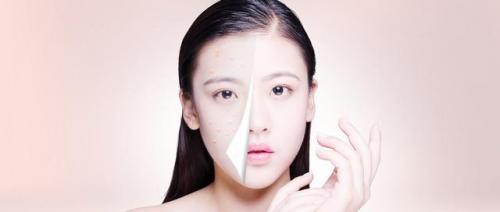 为什么青春期长「青春痘」？本文告诉你答案，男女都该看看