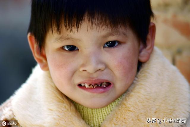 3岁孩子为何会蛀牙？儿科医生说：做好三个注意，有助远离龋齿
