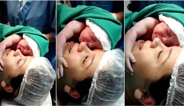 剖腹产要在妈妈的肚皮上划开8层？剖腹产有多痛经历过的人懂