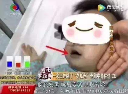 下个“火”，宝宝住到了重症病房！怎么败“火”最安全？