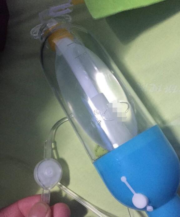 剖腹产后，使用镇痛泵和不使用镇痛泵啥区别？三点感受真不一样