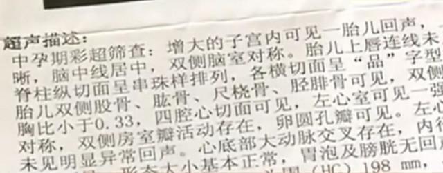 胎儿产前检查显示双手握拳，产后却没有右臂，医院回应让人气愤