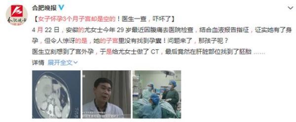 女子怀孕3个月，子宫却是空的！那孩子呢？ 医生感叹：极为罕见