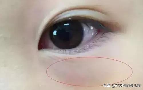 如何一眼看懂孩子是否长期脾虚？