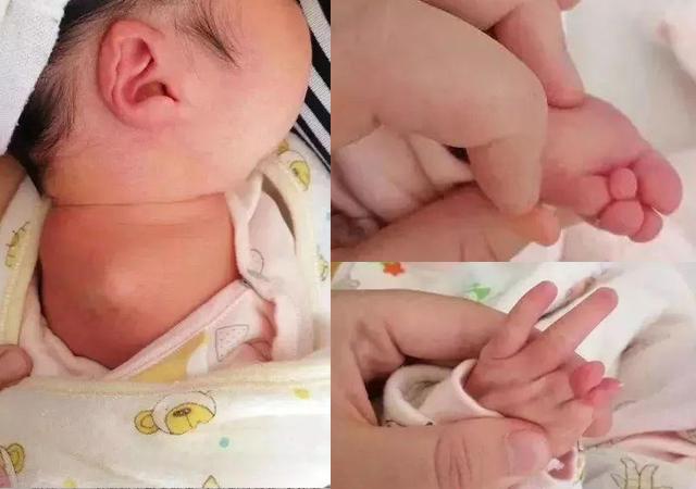 四维彩超报告正常，孩子出生却没右臂，准妈妈收好这份孕检须知