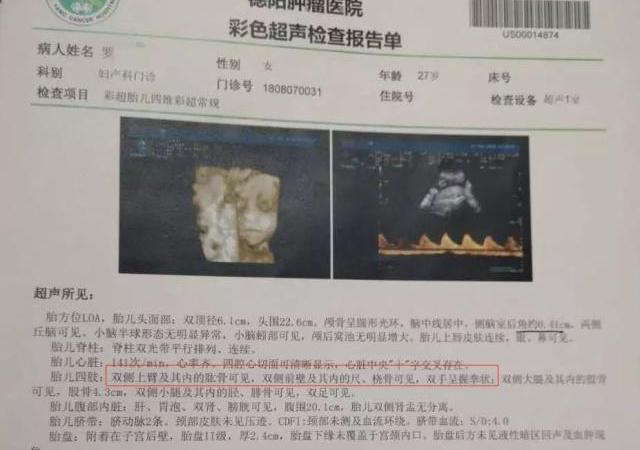 四维彩超报告正常，孩子出生却没右臂，准妈妈收好这份孕检须知