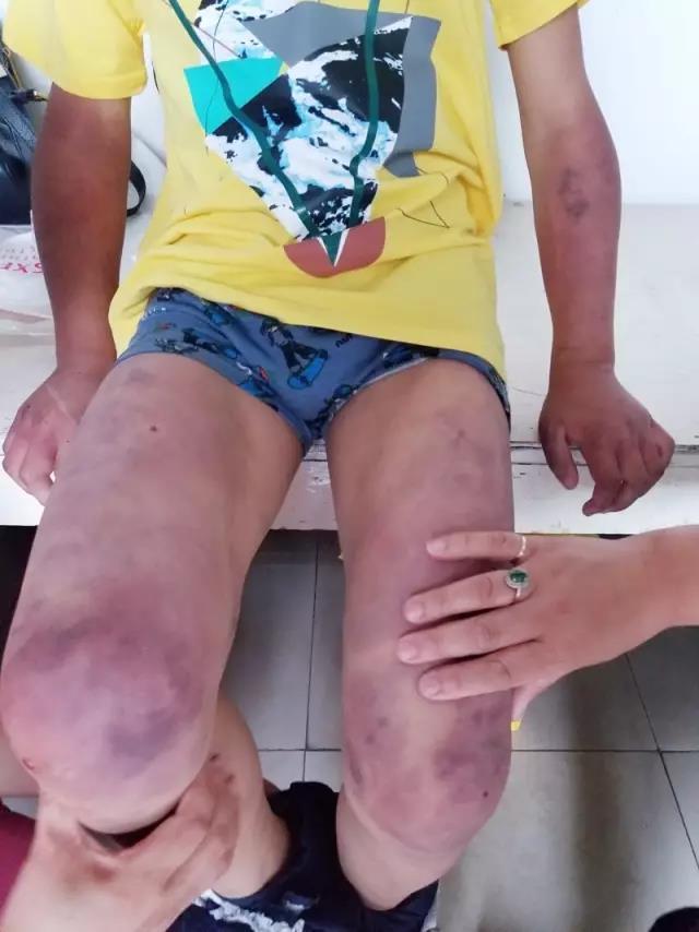 孩子身上这4个部位，个个都是生命线！家长再生气也不能打下手！