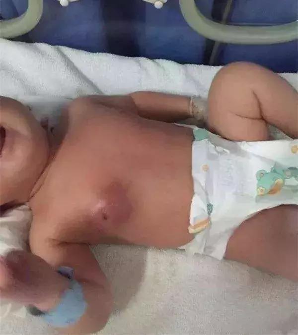 新生儿很娇嫩,这7件事不能对宝宝做