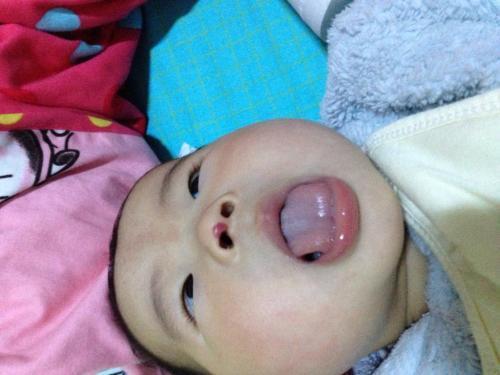 提醒家长：孩子这5个小毛病，说明积食了！家长别大意