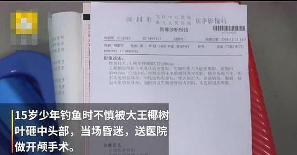 15岁男孩钓鱼被砸晕，脑袋被打30多根钢钉，父亲：被叶子打的