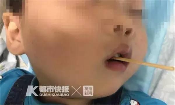 重要提醒！男孩吃烤肠时险些丧命，只因……近期家长更要当心！
