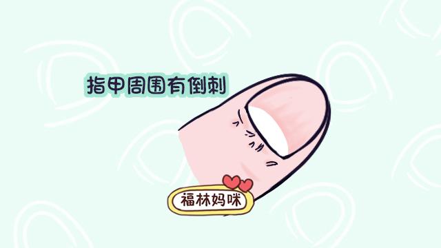 宝宝身体怎么样，看看指甲就知道，这6种表现妈妈要注意