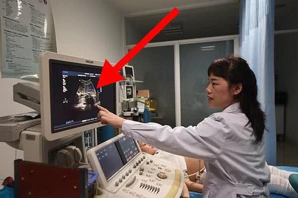 宫外孕和宫内孕是不同的感受，宝妈稍加留意就能分开，以免多受罪
