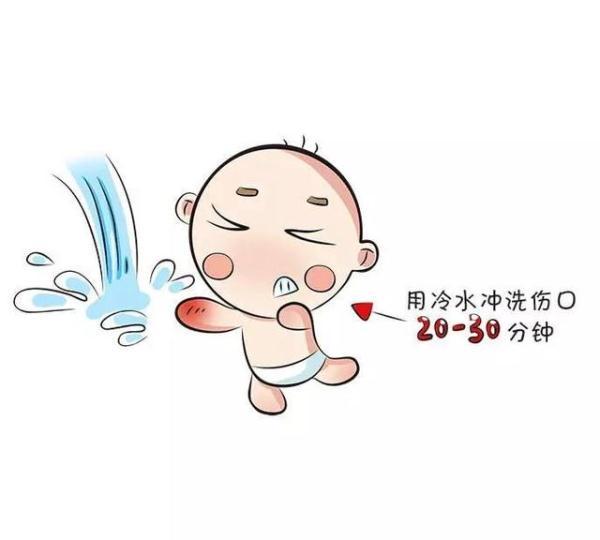 宝宝在户外烫伤后，爸妈该做和不该做的几件事