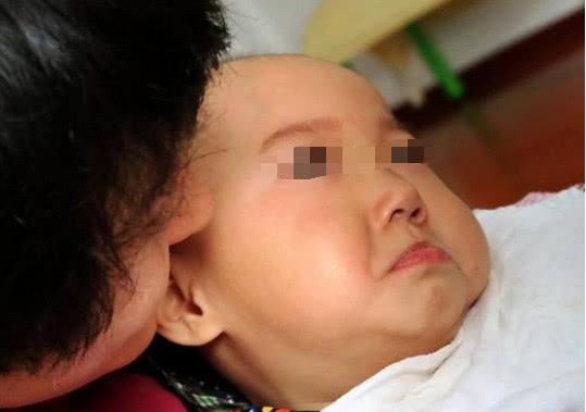 2个月大宝宝患上“脑瘫”，只因妈妈太疏忽大意！