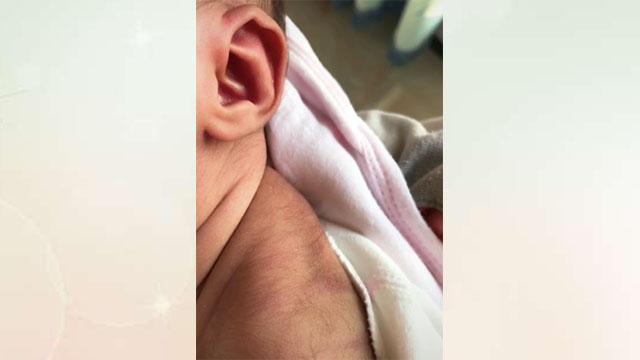 妈妈晒刚出生的宝宝，网友：为什么新生儿背上会长黑毛呢？