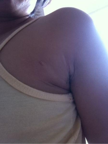 哺乳期的宝妈会长副乳吗？副乳对女性身体有什么危害呢？