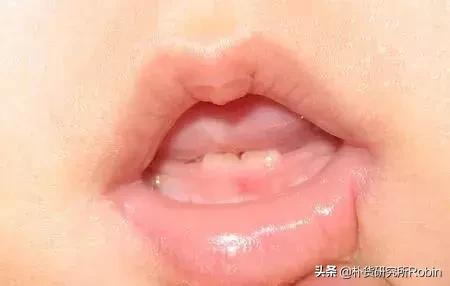 六个月大的宝宝会有这个变化，宝爸宝妈们必须谨慎对待