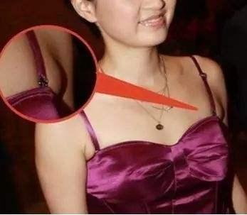 哺乳期的宝妈会长副乳吗？副乳对女性身体有什么危害呢？