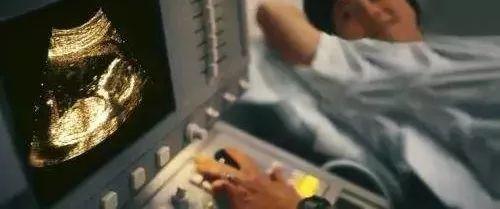 S/D值很重要吗？#清风计划#