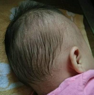 孩子睡觉，头爱出汗，是真的热吗？宝宝盗汗4大“苦衷”要知道
