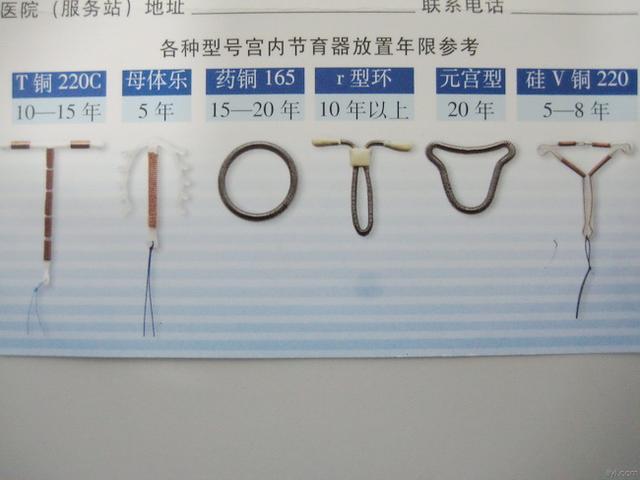 生完二胎后女性到底要不要上环？有几类女性直接被列入“黑名单”