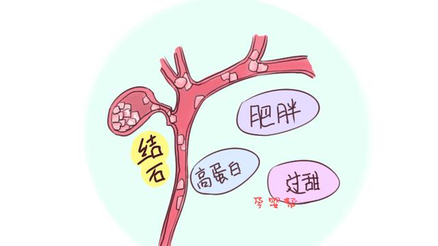22岁的宝妈刚出月子就要切除胆囊，原因竟和月子期吃鸡蛋有关