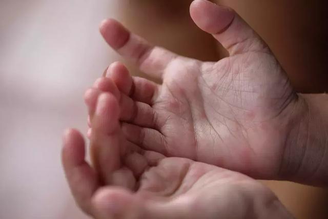 崔玉涛问答：宝宝手足口病该怎么护理？哺乳妈妈需要忌口吗？