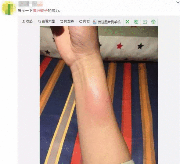 英女王御用的澳洲爆款驱蚊液，黄磊、胡可都给孩子用！| 种草机