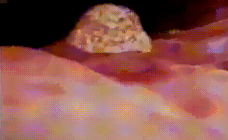 怀胎十月是怎样的？9张动图带你了解孕育过程，男人女人都要了解
