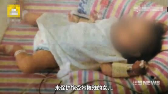 1岁多小宝宝无法坐立、说话、自己吃东西，只因母亲全素食喂养
