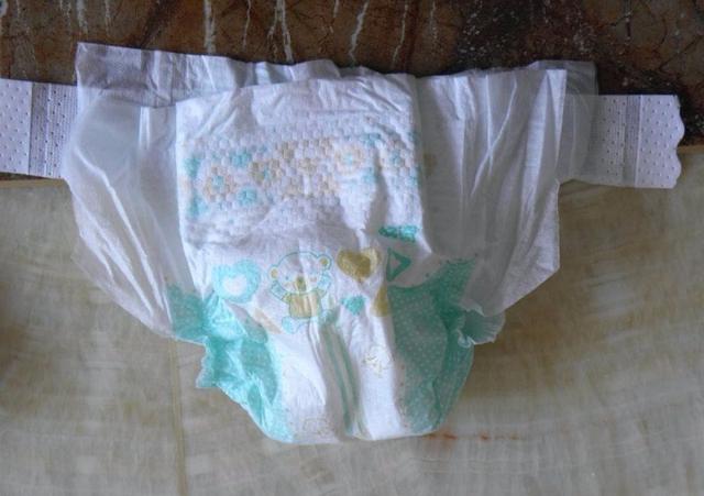 给宝宝换纸尿裤，要注意4个方面，才能让他舒服又健康